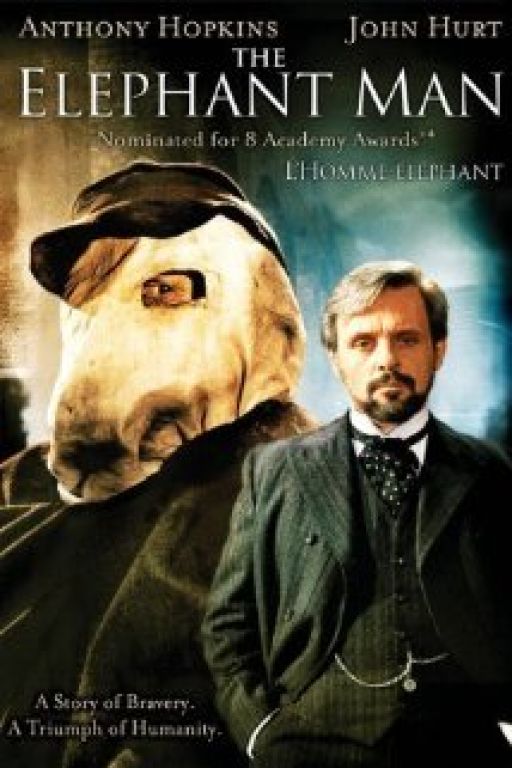 Der Elefantenmensch – The elephant man 